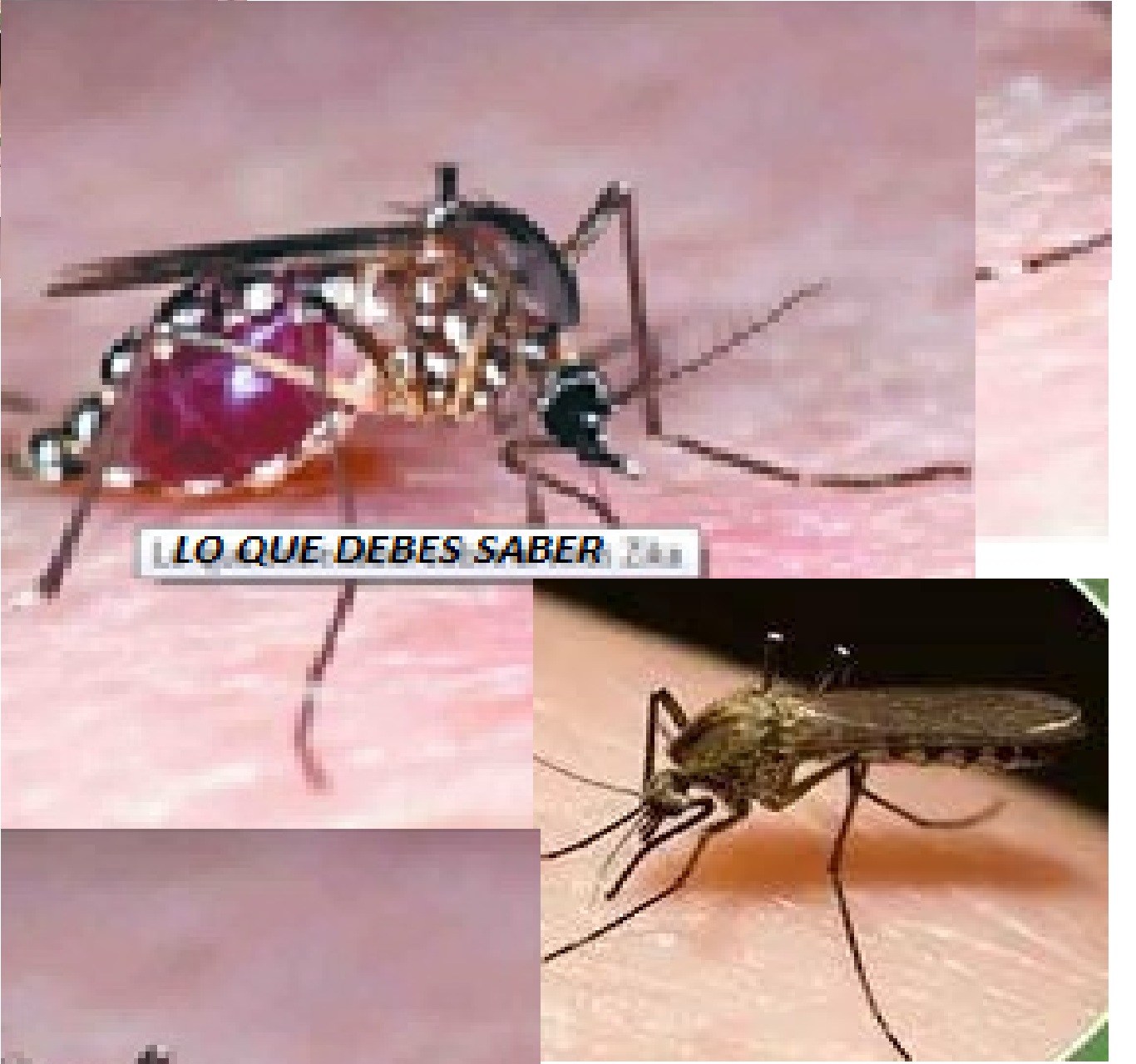 ZIKA2